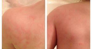 Before After